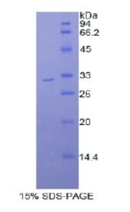 Mouse MYO1B / Myosin IB Protein (Recombinant His)