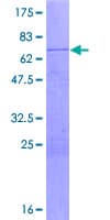 Human DHH / Desert Hedgehog Protein (Recombinant GST)