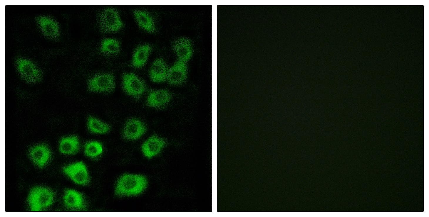 ARFGAP1 Antibody