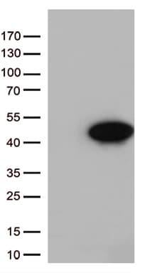ARG1 / Arginase 1 Antibody (clone OTI4H7)