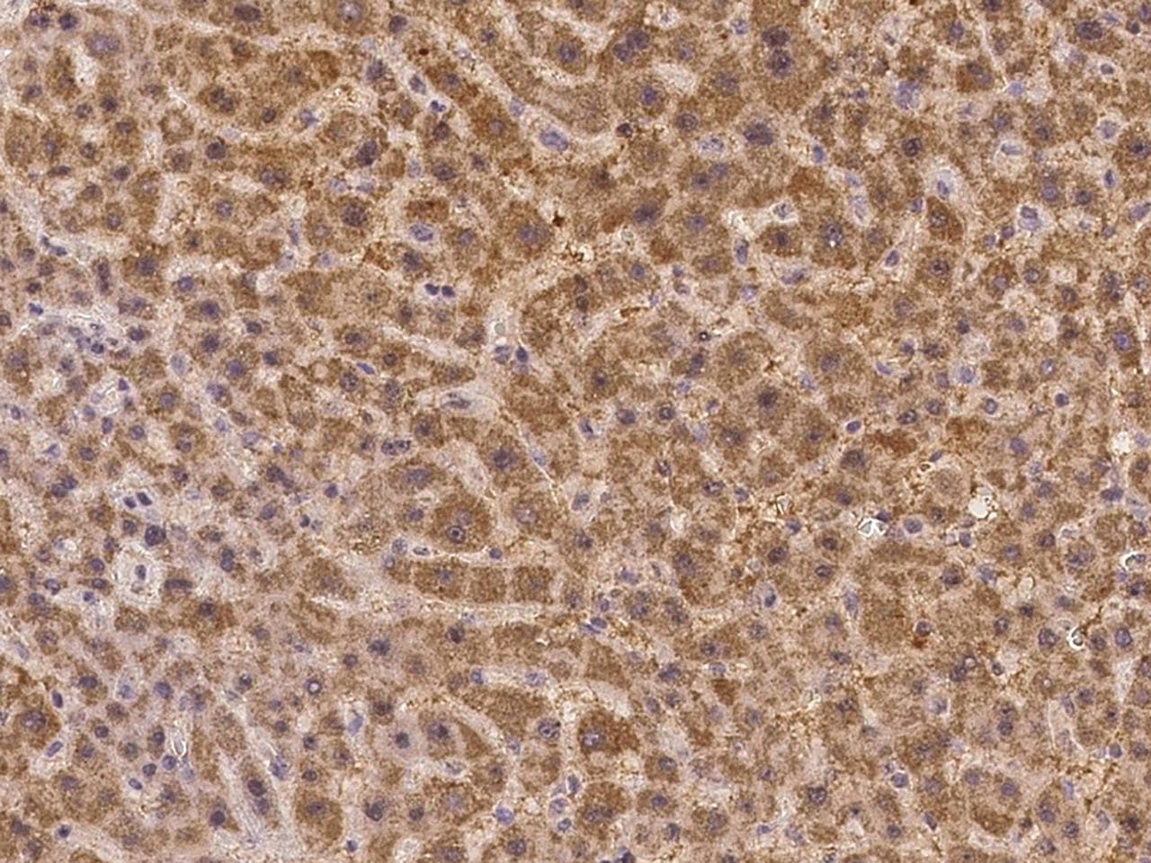 Polyclonal Rabbit anti-Human KIF25 Antibody (IHC)
