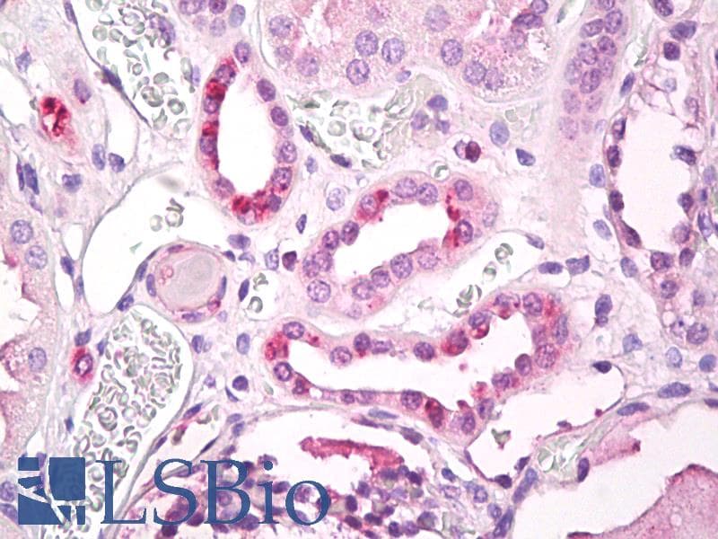 IHC-plus™ Polyclonal Rabbit anti-Human STRADB / ALS2CR2 Antibody (aa200-250, IHC, WB)