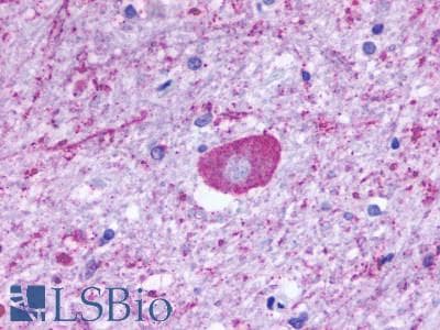 PathPlus™ Polyclonal Rabbit anti-Human GPR137B Antibody (C-Terminus, IHC)