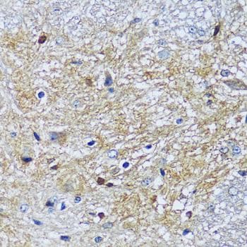 CAMK1 / CAMKI Antibody
