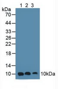 S100A6 / Calcyclin Antibody (aa1-90, PE)