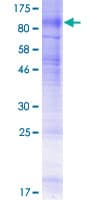 Human SLC5A1 / SGLT1 Protein (Recombinant GST)