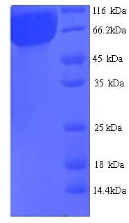 Aspergillus niger Alpha-Galactosidase B Protein (Recombinant His)