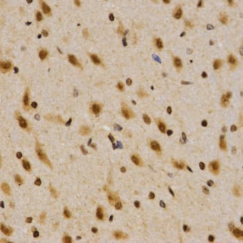 IHC-plus™ Polyclonal Rabbit anti-Human SKIV2L2 Antibody (IHC, WB)