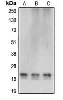 Polyclonal Rabbit anti-Human CBLN4 / Cerebellin 4 Antibody (C-Terminus, IHC, WB)