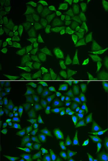 Polyclonal Rabbit anti-Human CLPS / Colipase Antibody (IHC, IF, WB)