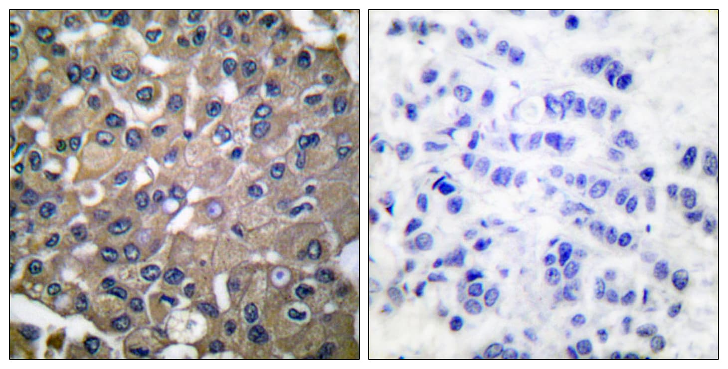 MMP9 / Gelatinase B Antibody (aa651-700)