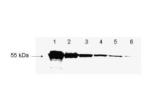 DYKDDDDK Tag Antibody
