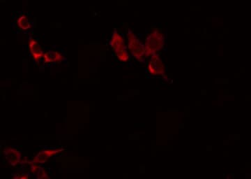 EPCAM Antibody