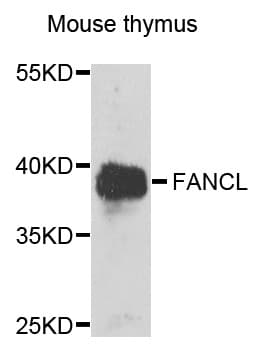 Polyclonal Rabbit anti-Human PHF9 / FANCL Antibody (IHC, WB)