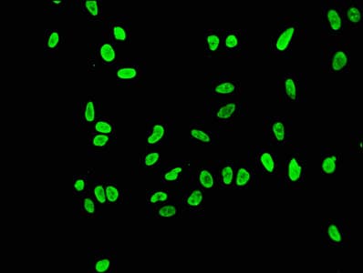 Recombinant Monoclonal Rabbit anti-Human HIST1H3A Antibody (IF, WB)