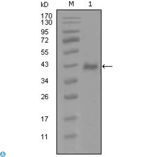 AR / Androgen Receptor Antibody