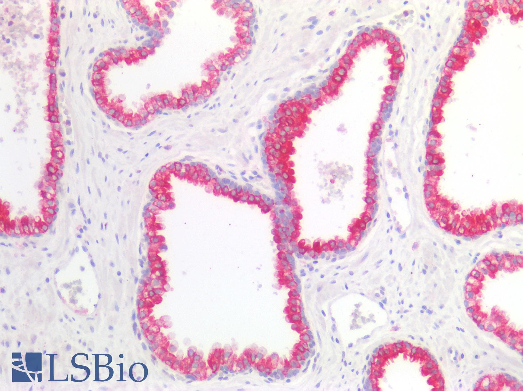 PathPlus™ GDF15 Antibody