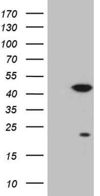 CDK20 / CCRK Antibody (clone OTI1B3)