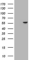 ATP6V1B2 Antibody (clone 1.00E+11, Carrier-free)