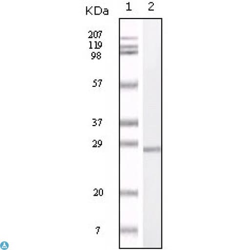 S100B / S100 Beta Antibody