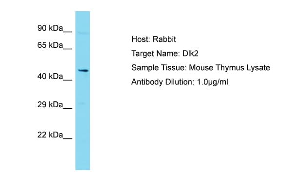 Polyclonal Rabbit anti-Mouse DLK2 Antibody (aa292-341, WB)