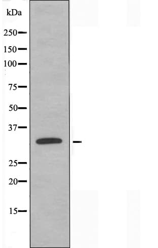S100A5 Antibody