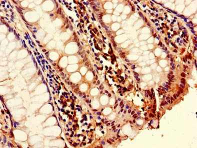 TNFSF11 / RANKL / TRANCE Antibody