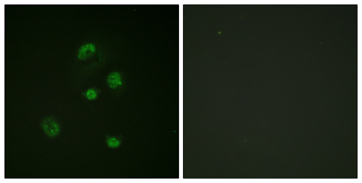 DDIT3 / CHOP Antibody (phospho-Ser30)