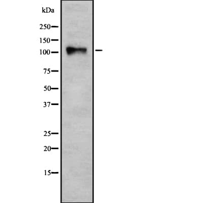 Polyclonal Rabbit anti-Human CARD10 / CARMA3 Antibody (IF, WB)
