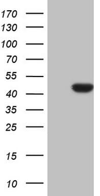 CDKL1 Antibody (aa152-357, clone OTI1H4, Carrier-free)