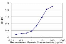 IHC-plus™ FADS1 Antibody (clone 2D9)