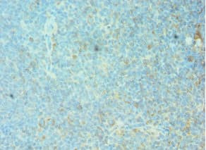 FRA-1 / FOSL1 Antibody (aa1-100)