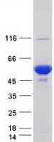 Human PRKAR1B Protein (Recombinant Myc-DDK (Flag))