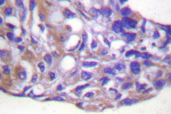 PPP1R12A / MYPT1 Antibody (Arg690)