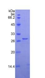 Human CELA3B / ELA3B Protein (Recombinant His, N-Terminal)