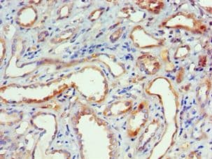 Polyclonal Rabbit anti-Human MAPK13 / p38delta Antibody (aa1-365, IHC)