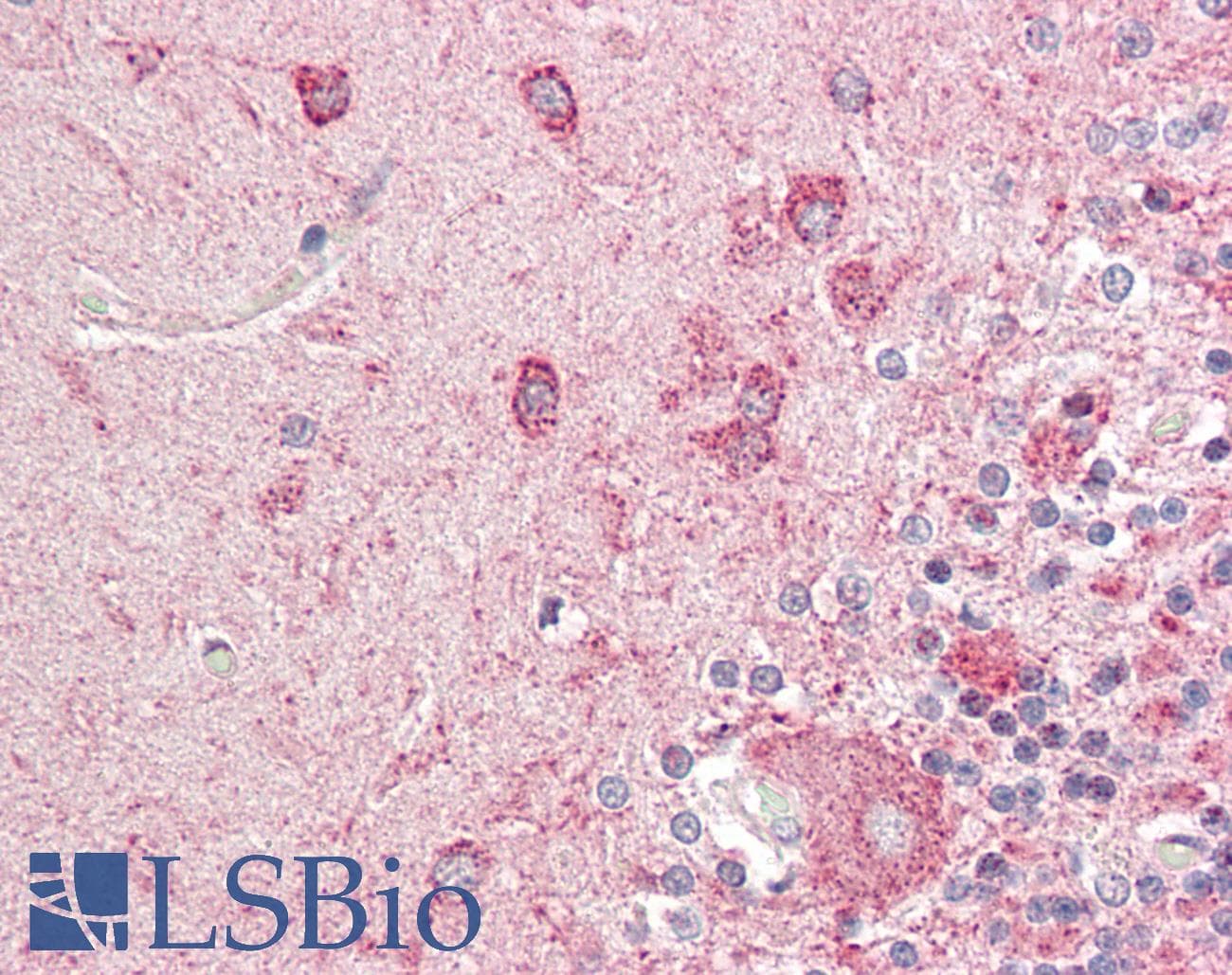 IHC-plus™ Polyclonal Rabbit anti-Human NTRK2 / TRKB Antibody (aa481-530, IHC, WB)
