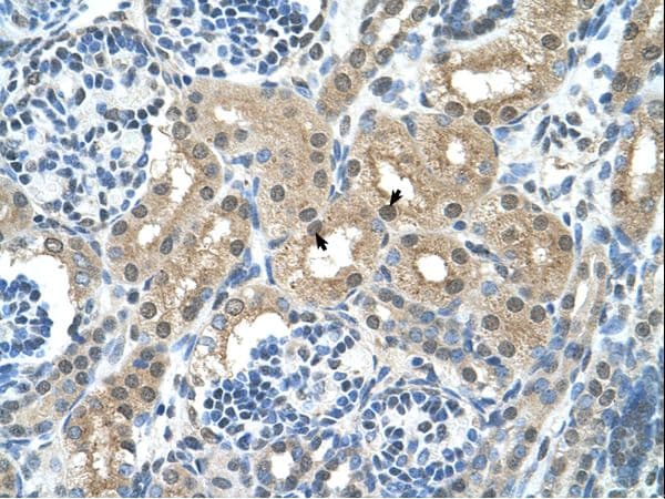 GPT / Alanine Transaminase Antibody (aa81-130, HRP)