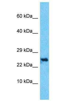 C10orf131 Antibody (aa124-173)