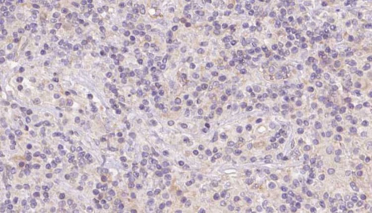 HBE1 / Hemoglobin Epsilon 1 Antibody