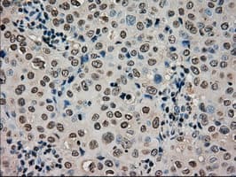 CTAG1B / NY-ESO-1 Antibody (clone OTI3C9)