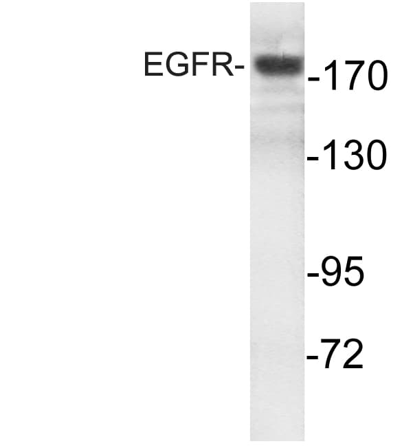 EGFR Antibody (Ser1166)