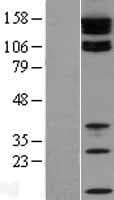 Human TJP2 / ZO2 / ZO-2 Protein (Over-Expression Lysate Myc-DDK (Flag))