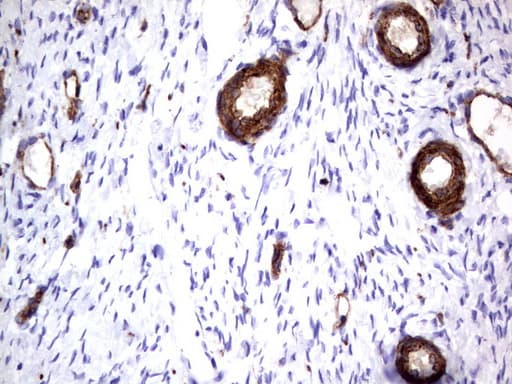 MCAM / CD146 Antibody (clone UMAB154)