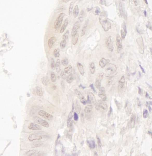 CASC5 Antibody (aa300-350)