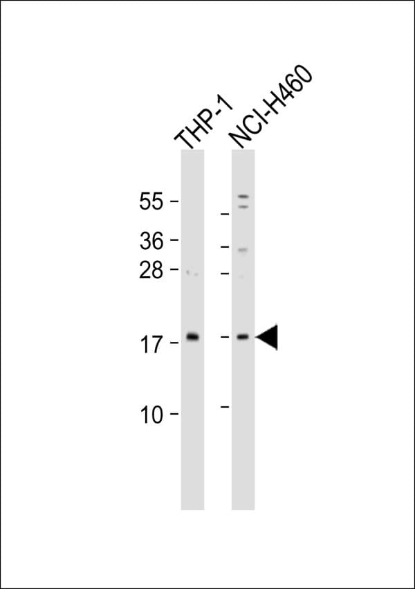 RPS13 / Ribosomal Protein S13 Antibody