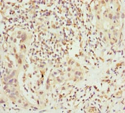 CHIC2 Antibody