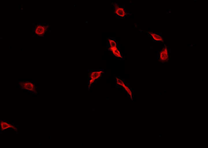 CDC25B Antibody