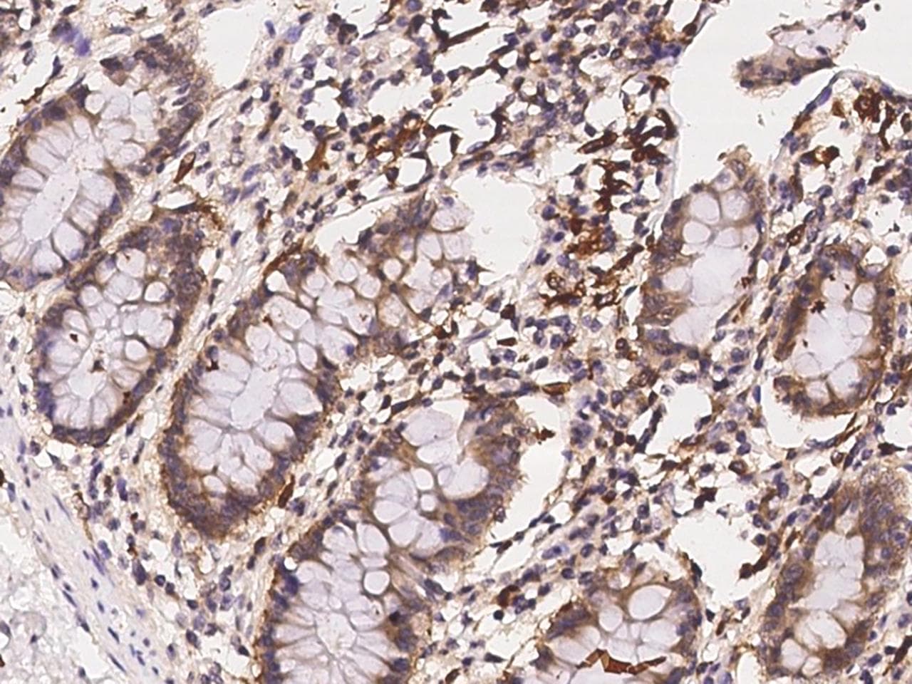 GLMN Antibody