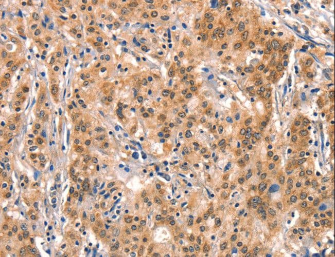 AIMP1 / EMAP II Antibody